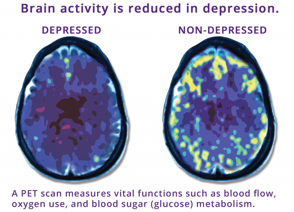 Mark-George-Brains-1024x817.png