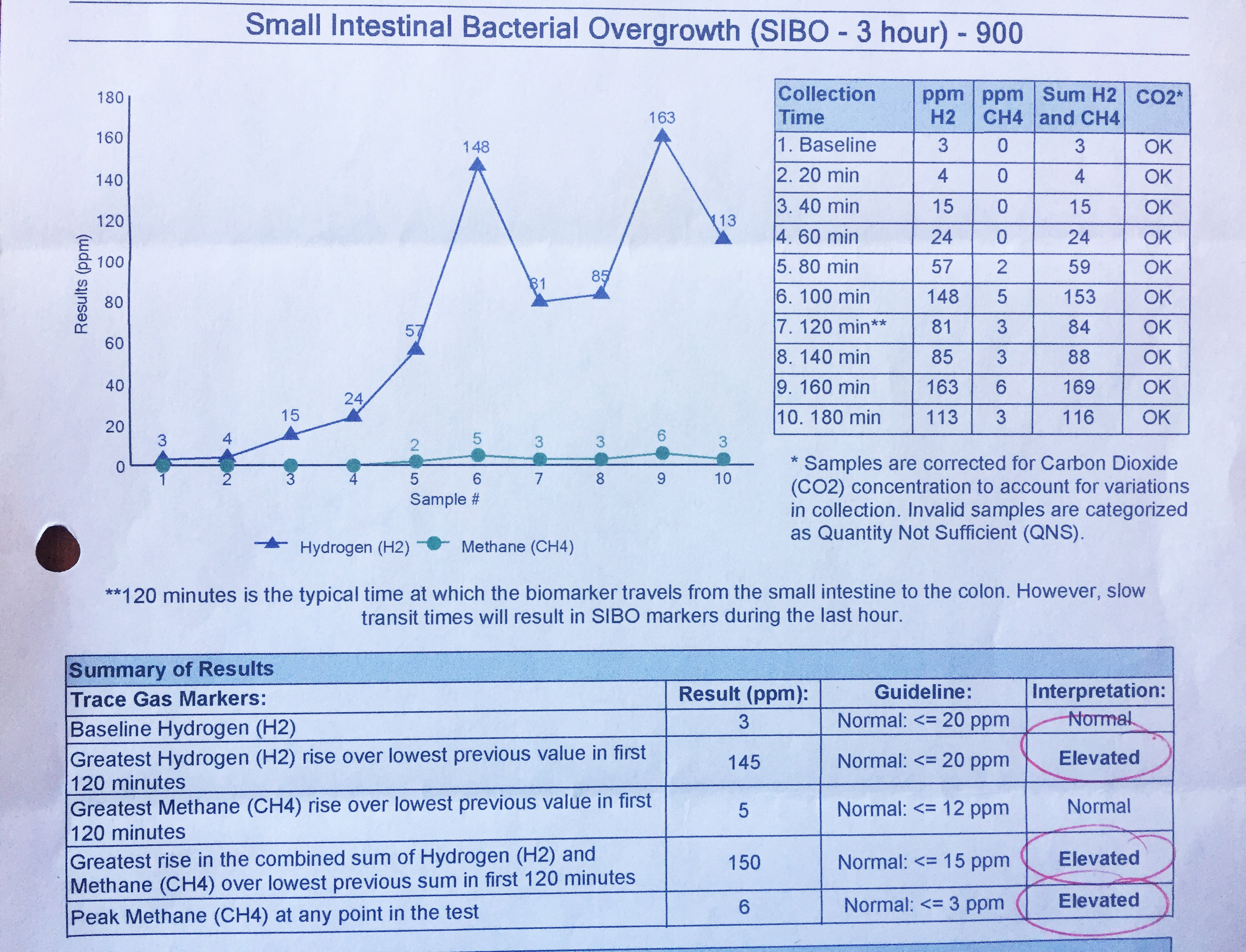 First SIBO Breath Test Results: Severe case of SIBO