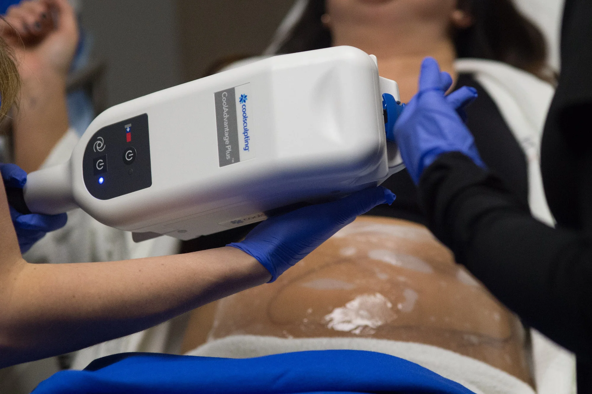 CoolSculpting VIP Day