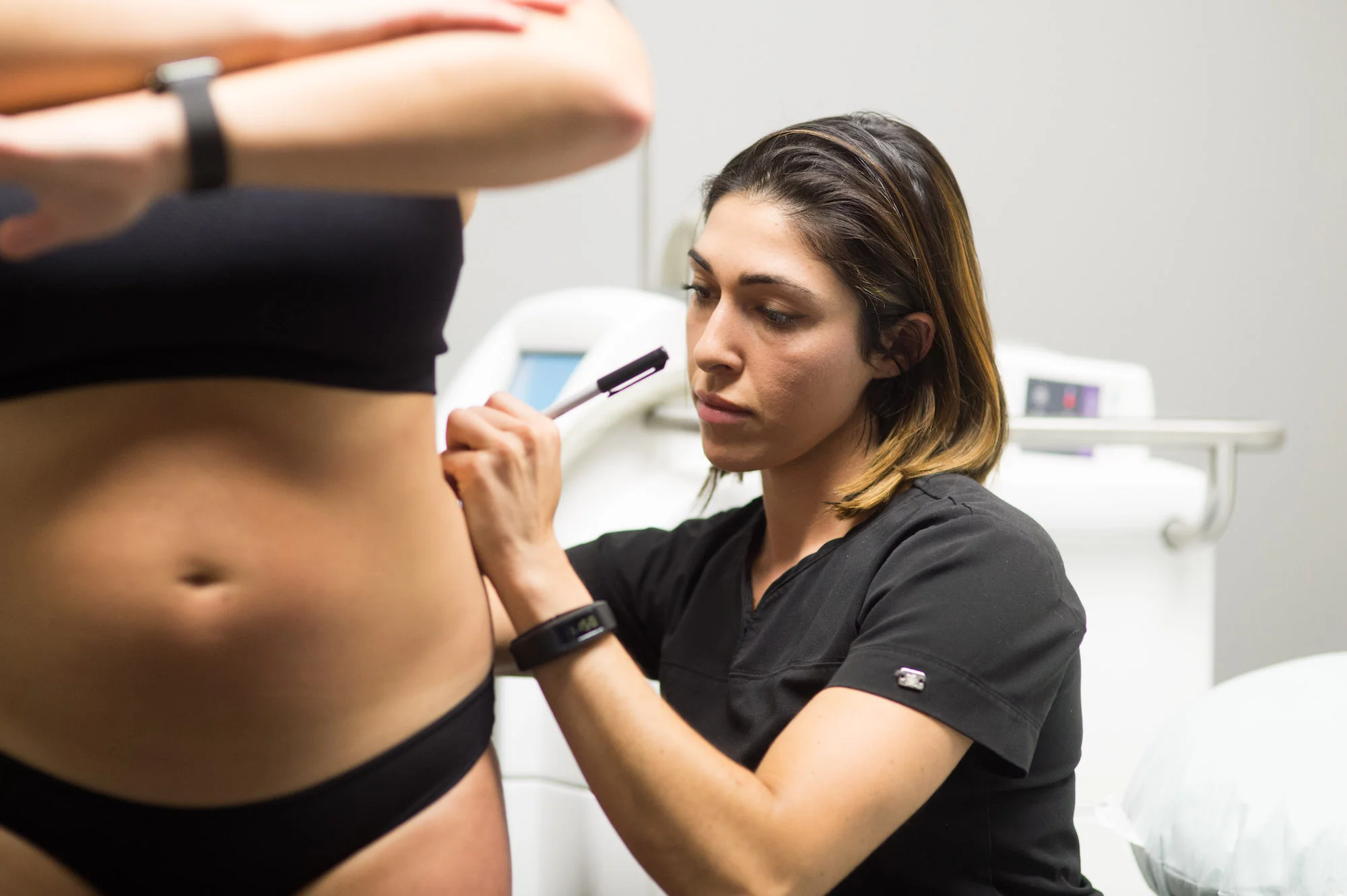 Live CoolSculpting Demonstration