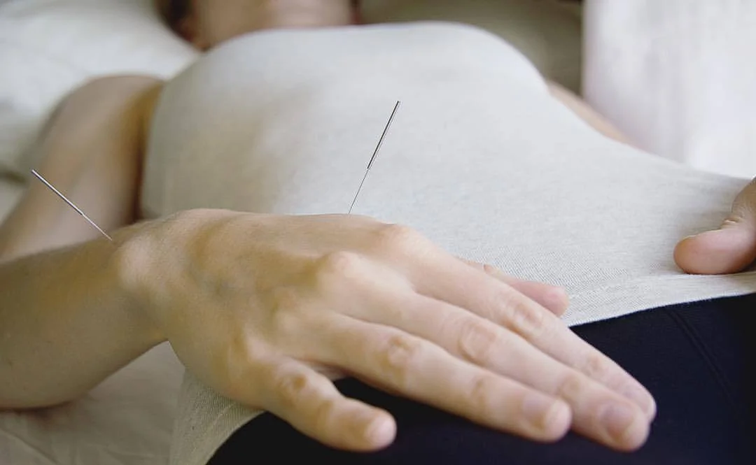In 2008: “Acupuncture works better than drugs like aspirin to reduce the severity and frequency of chronic headaches, U.S. researchers reported on Monday.” A review of studies involving nearly 4,000 patients with migraine, tension headache and other forms of chronic headache showed that that 62 percent of the acupuncture patients reported headache relief compared to 45 percent of people taking medications, the team at Duke University found.
.
In 2017: A CNN report / Published in the journal JAMA Internal Medicine, a group of Chinese scientists found that acupuncture “significantly reduced” the frequency of attacks for those suffering from migraines without auras. The frequency and severity of migraine headaches was reduced in the group of 249 participants.
.
.
Headaches / Just a sampling of studies above. One of the many health issues your acupuncturist can address. ❤
.
.
.
#acupuncture #headache #naturalhealth #wellness #holistichealth #chinesemedicine #pain #medicinekitchen #acupuncturist #healing #chronicpain #migraine #relaxed #painfree #womenshealth #research #atx