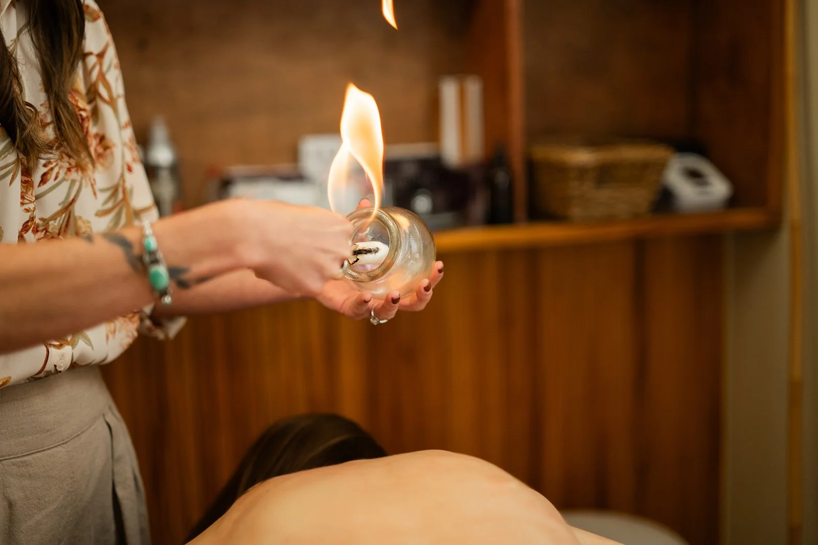 How Often Should You Get Cupping Therapy?