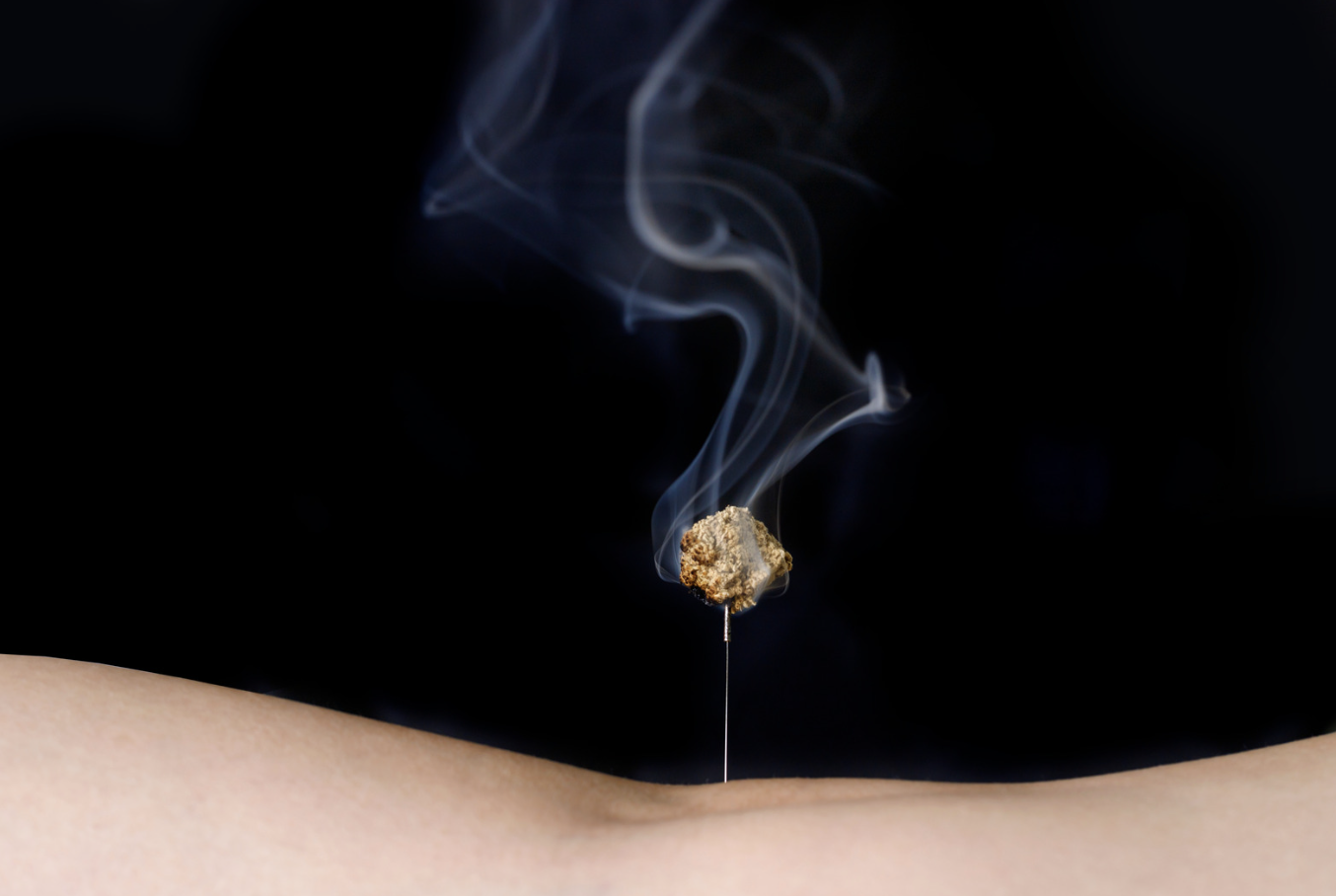Moxibustion in Boulder: How This Warming Therapy Supports Acupuncture Treatment at Jade Mountain Health