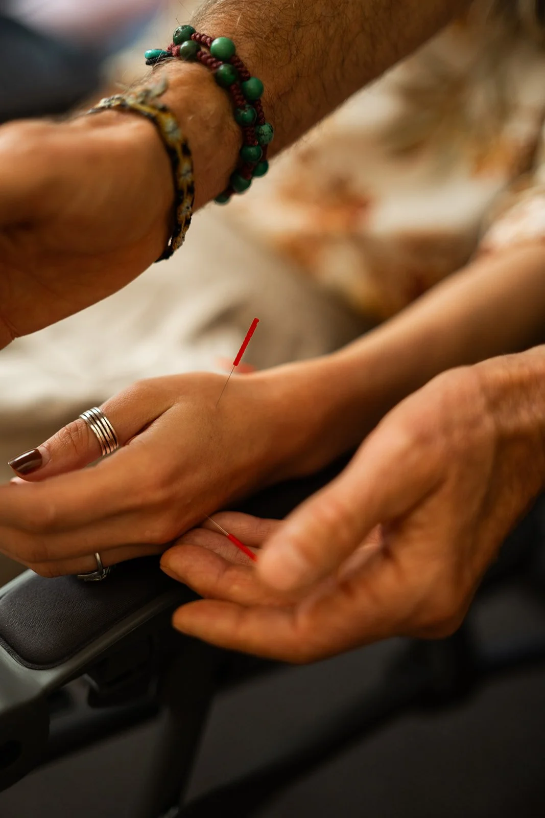 acupuncture alongside therapy can help heal trauma