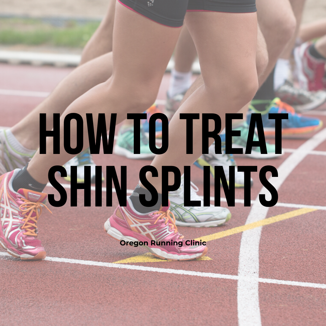 How to Treat Shin Splints