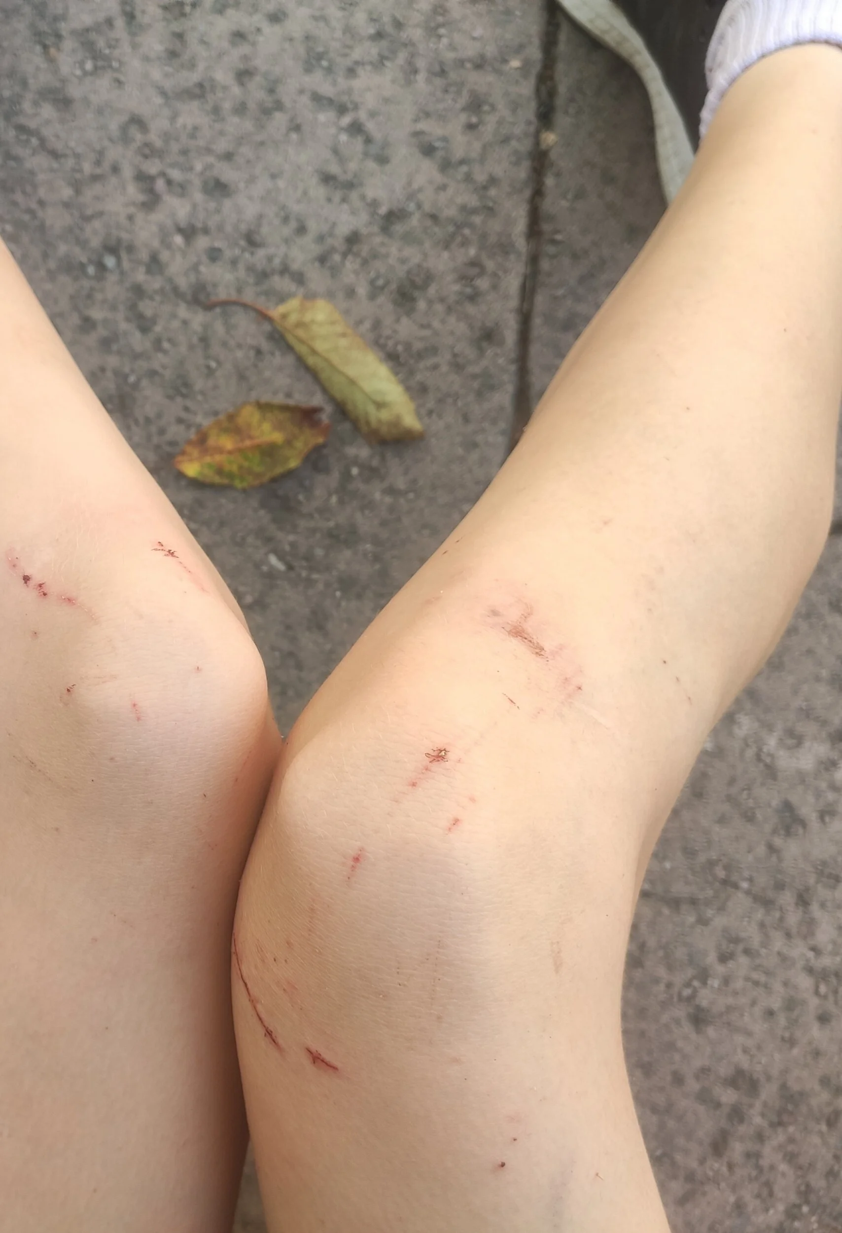 picking at old scabs for no reason