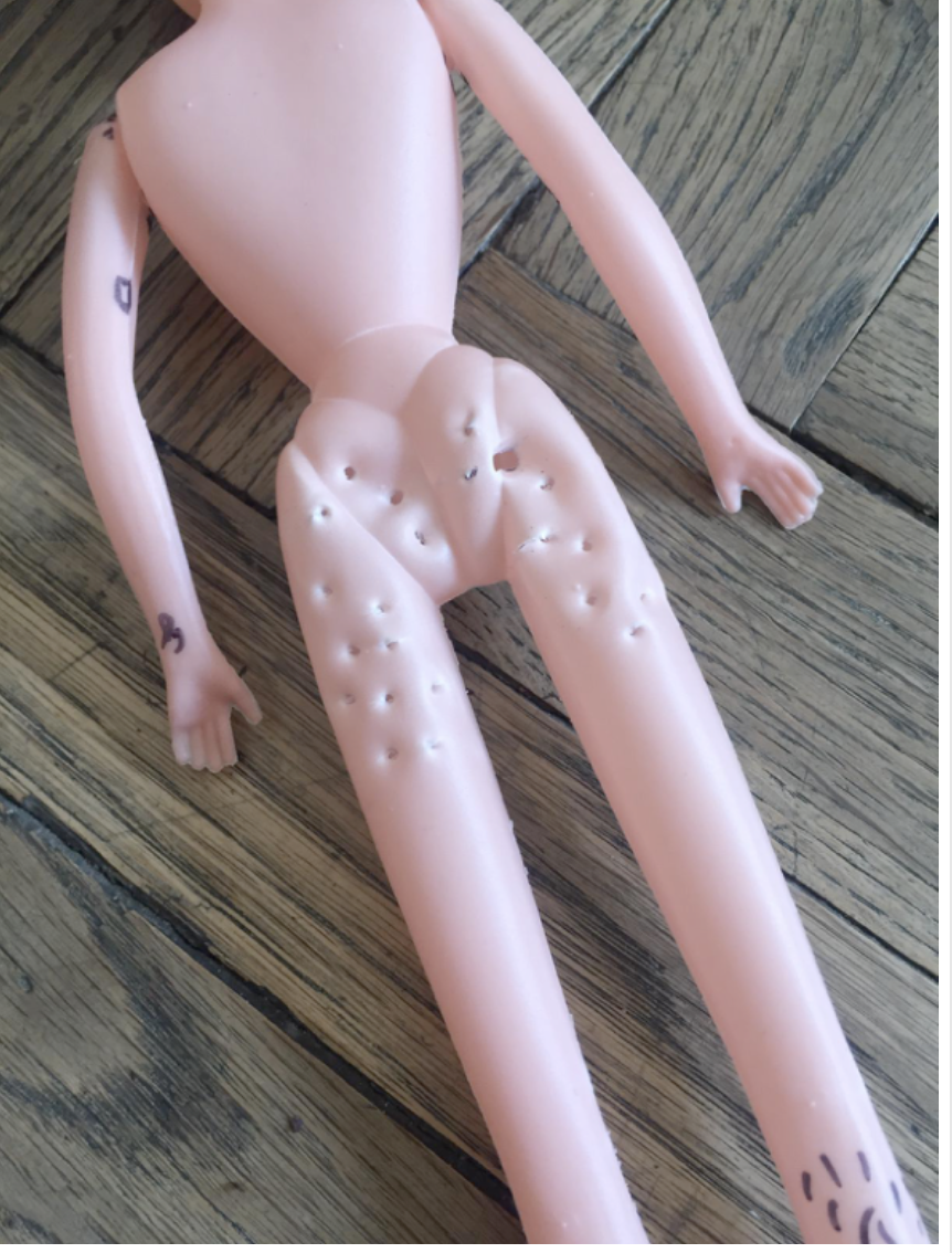 3 cellulite.png