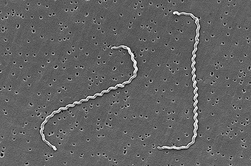 Lepstospirosis-causing bacteria