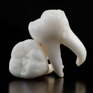 wisdom-teeth-square-300x300.jpg