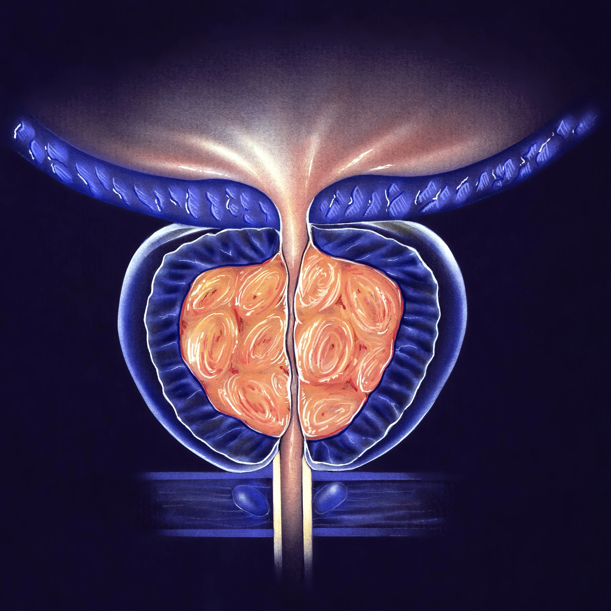 prostate.jpg