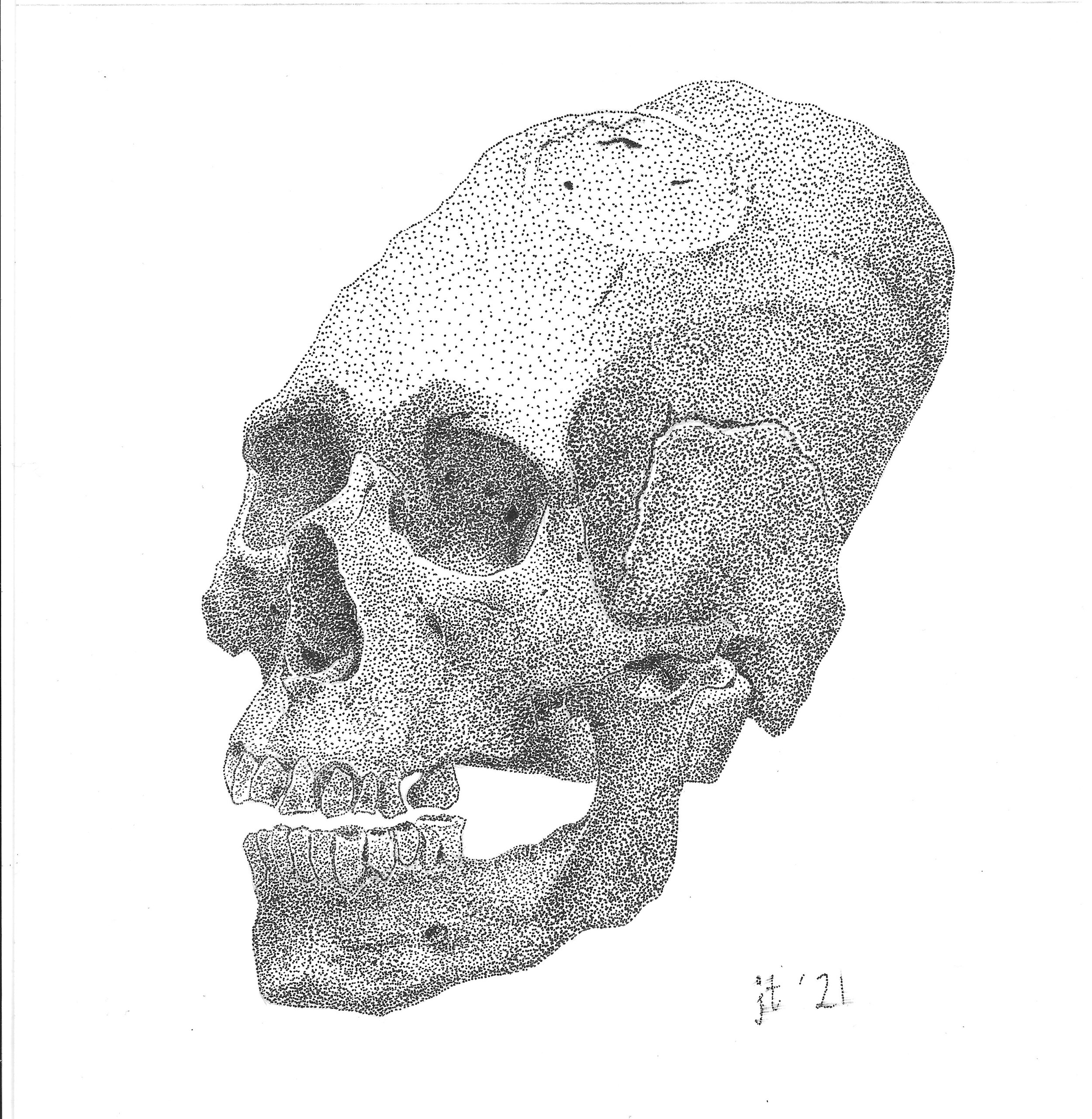 Peruvian Male Skull (with Cranial Binding & Trephination), 2021
