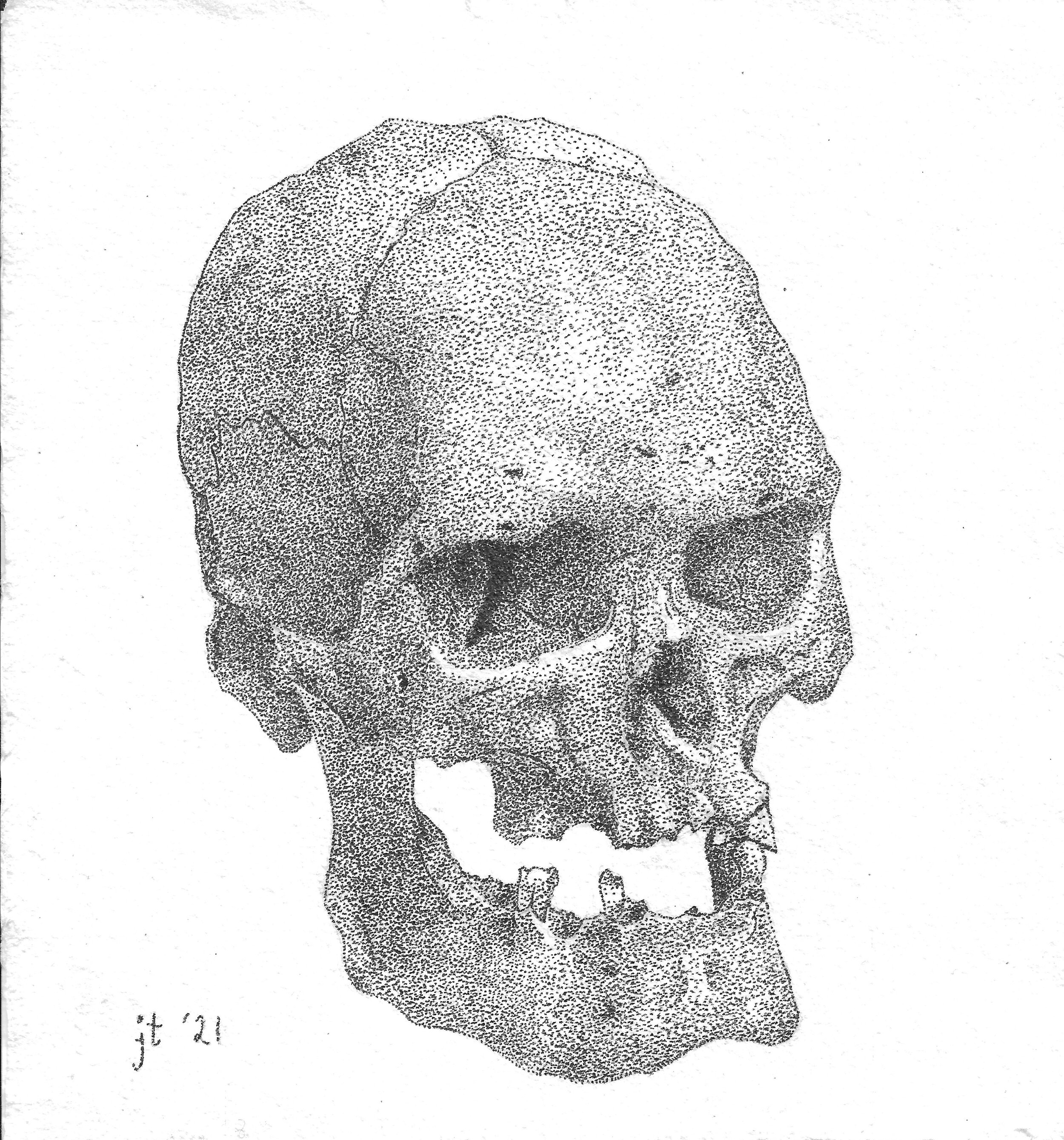 Human Male Skull (Acromegaly), 2021