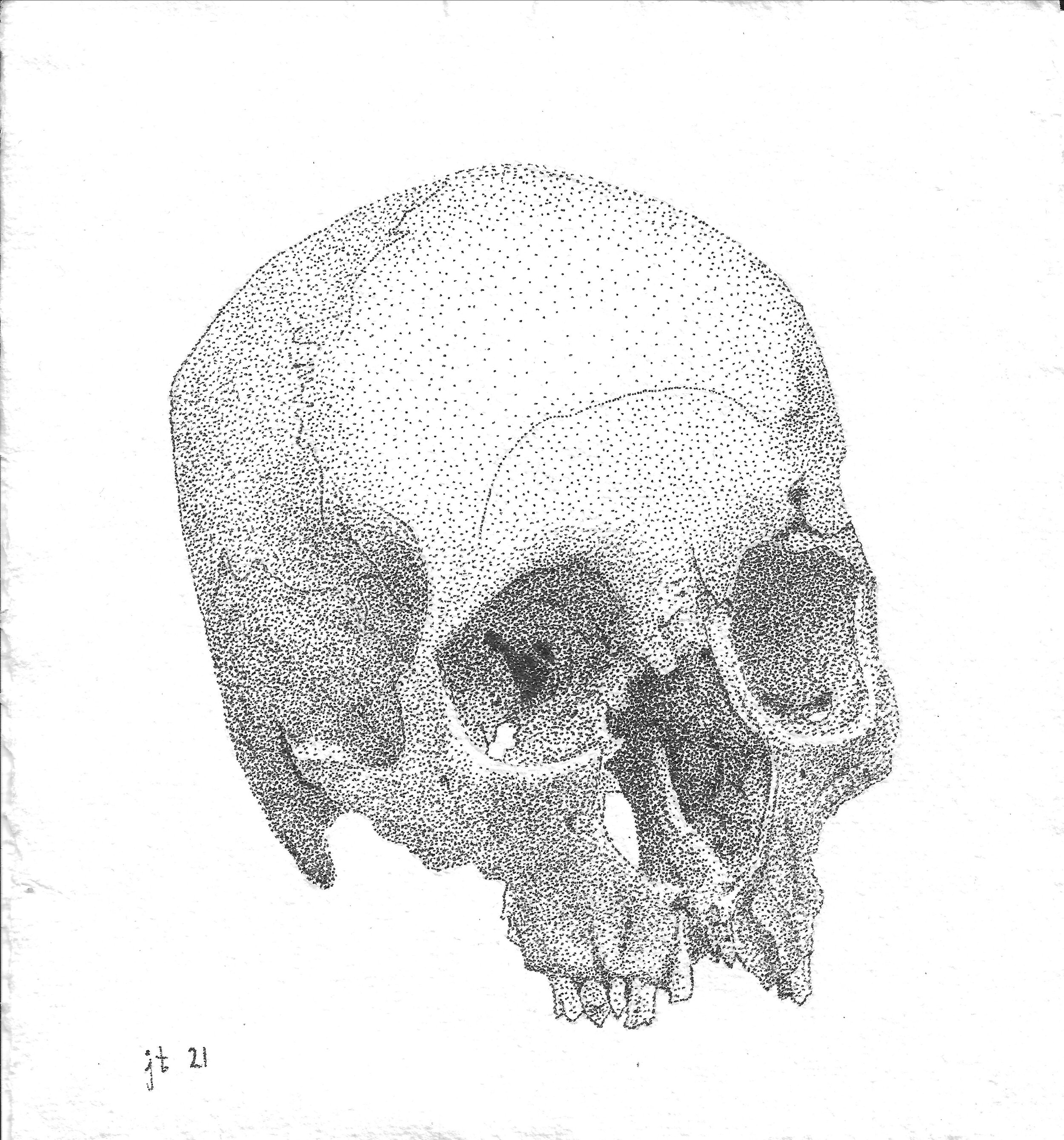 Human Cranium (Blunt Force Trauma, Eye Orbit), 2021