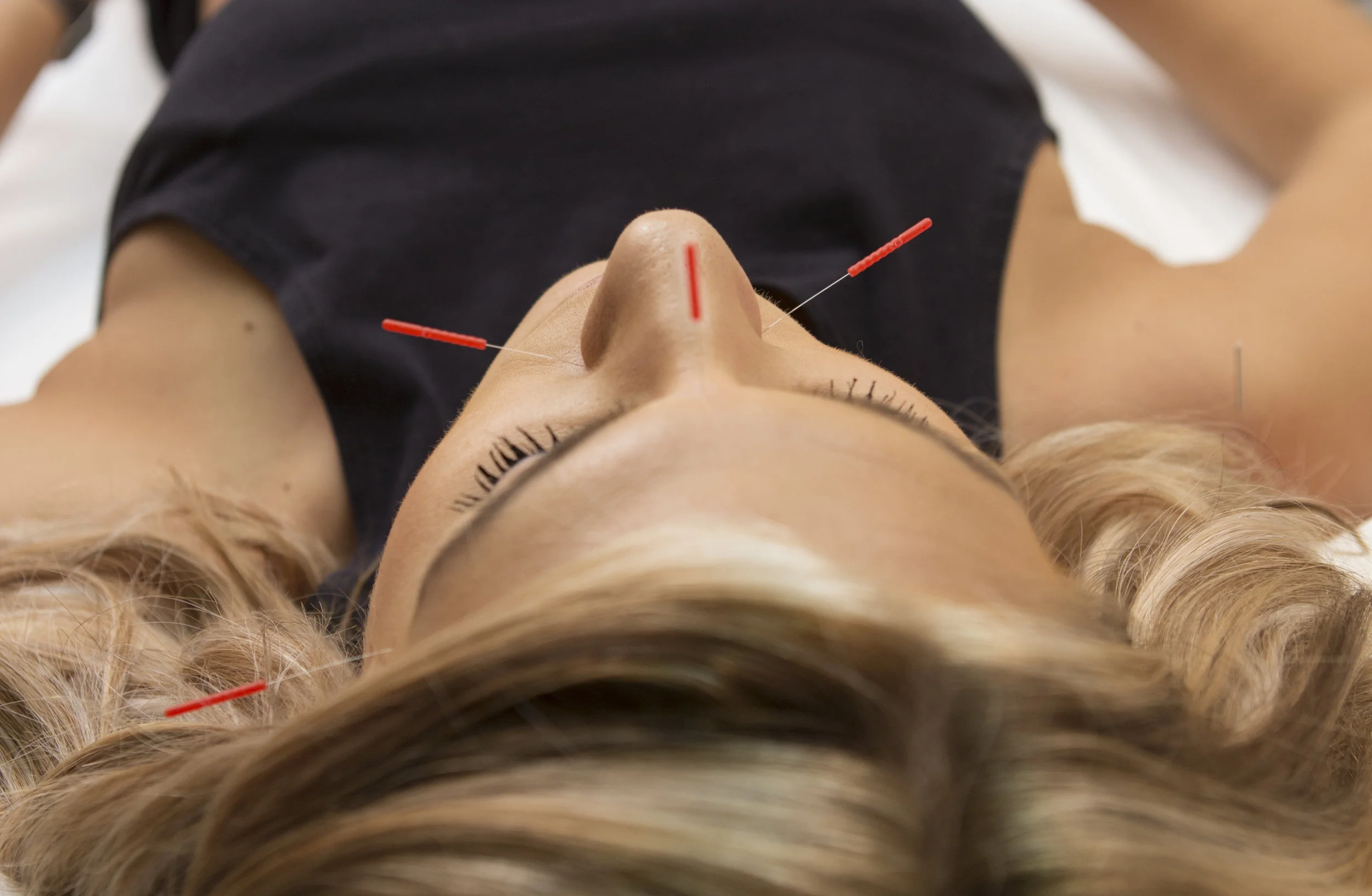 acupuncture face header 4.jpg