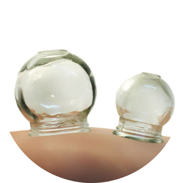 cupping 3.jpg