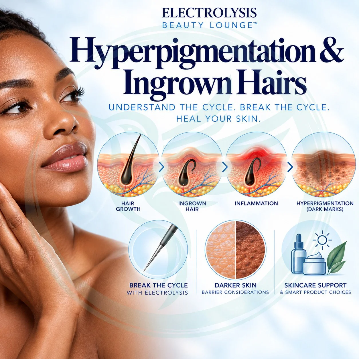 An infographic explaining hyperpigmentation and ingrown hairs, their cycle, and solutions including electrolysis, with sections on breaking the cycle, healing, skincare, and results.