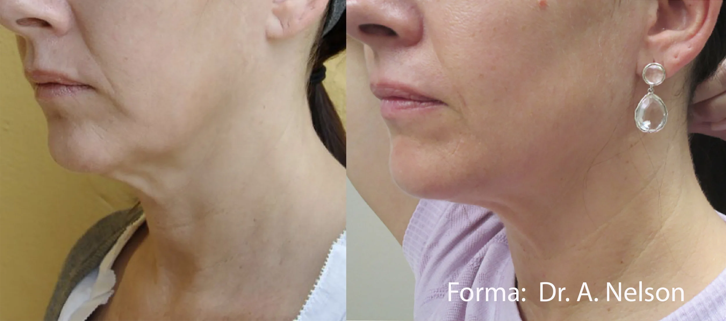 AN_Forma_1a_LS_Face_8tx55mj_43.jpg