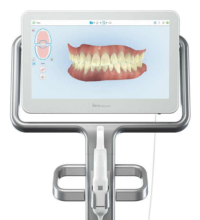 Say HELLO to iTero® Digital Impression System