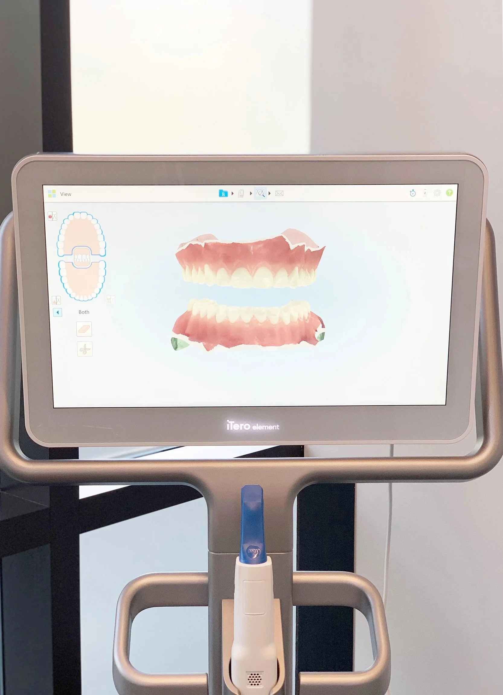 iTero digital 3D intraoral scanner used to create precise digital impressions for crowns, orthodontics, clear aligners, retainers, and night guards at The Smile Space.