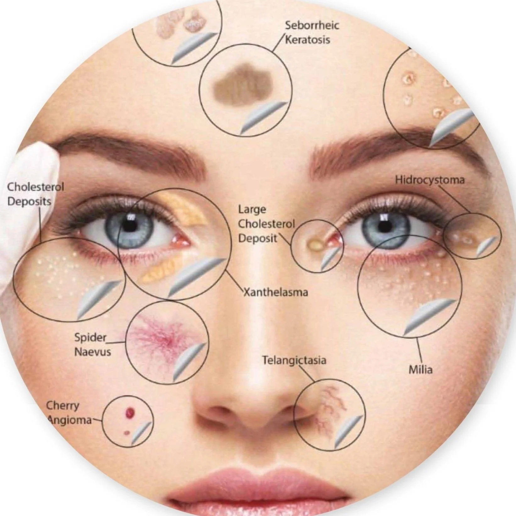 The new treatment tool we love - yes love!