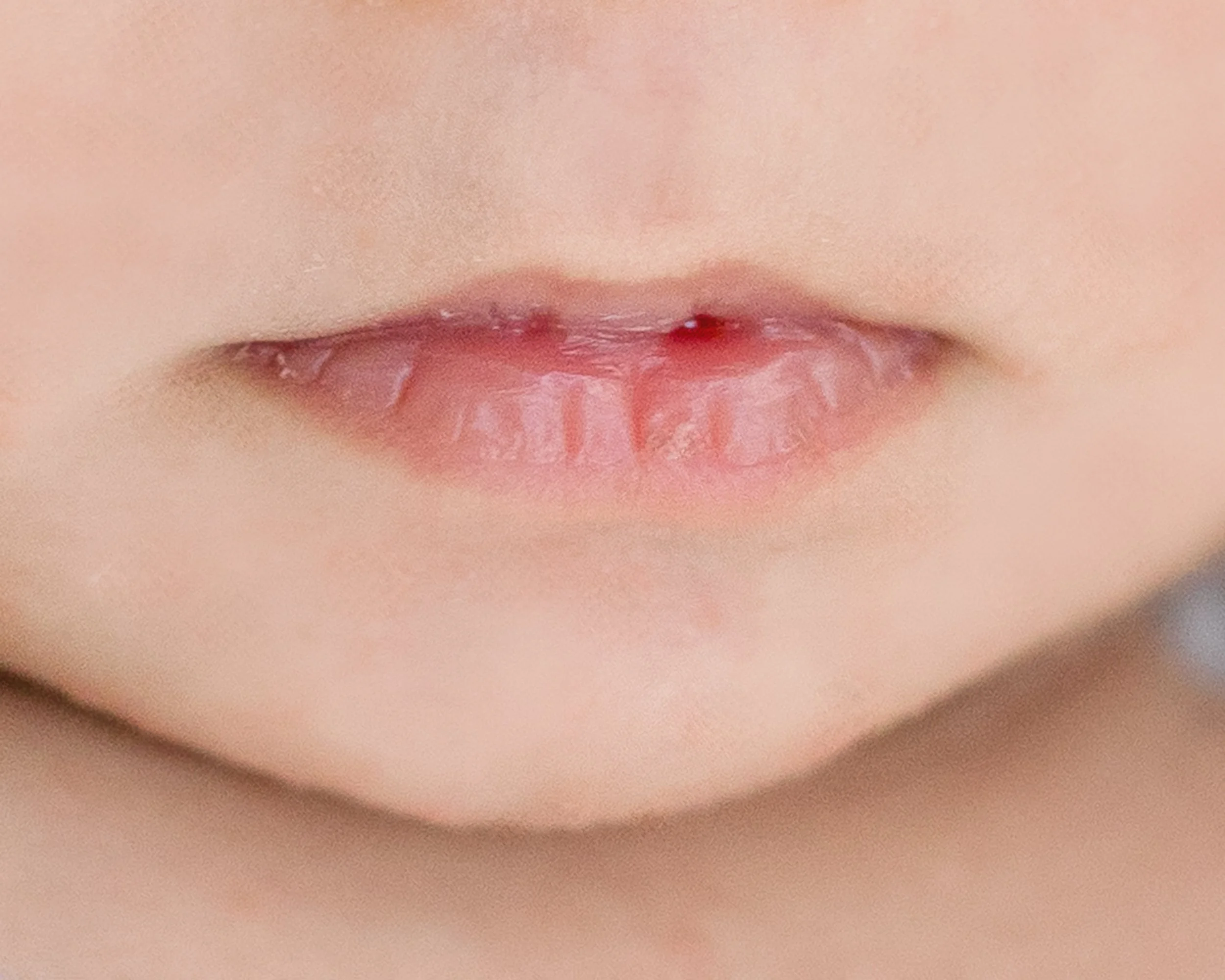Detail of baby lips in newborn studio session in Oshawa