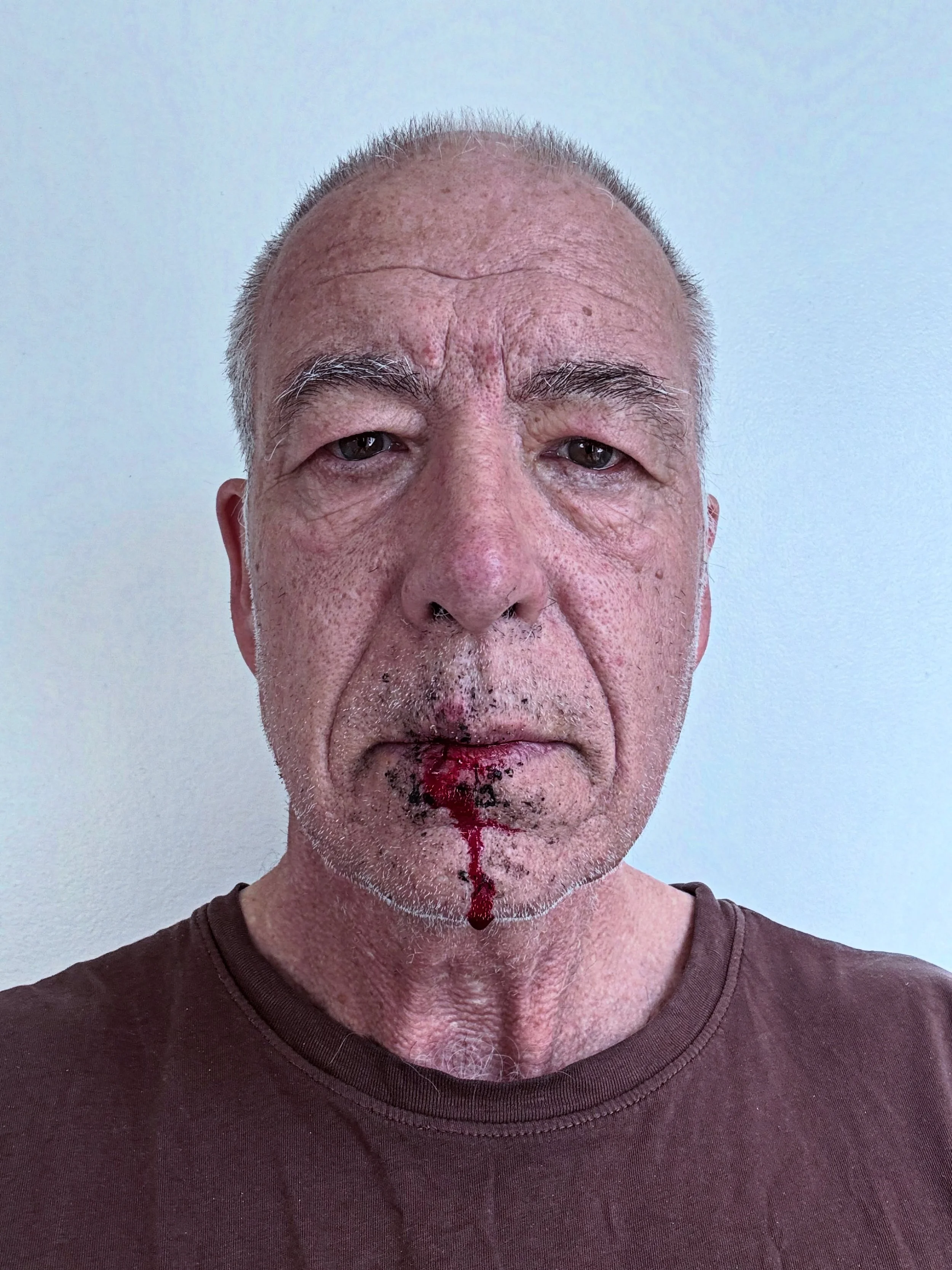 #selfportrait #bloodylip #photoself #photoselfportrait