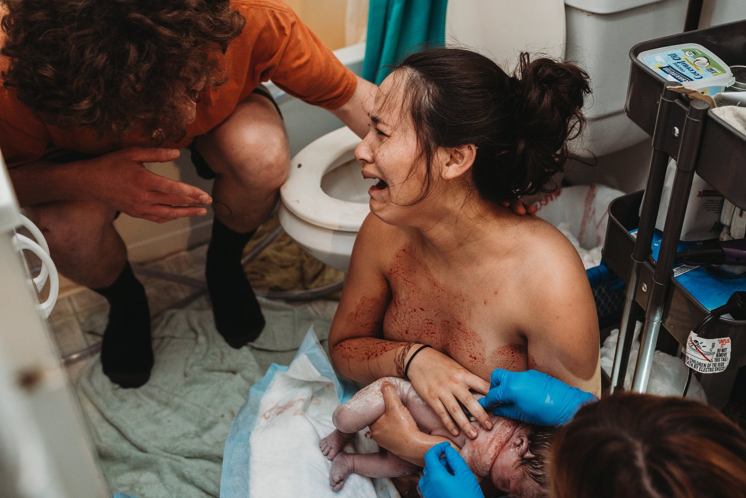 Nuchal Hand Birth Blog Magpi Midwifery