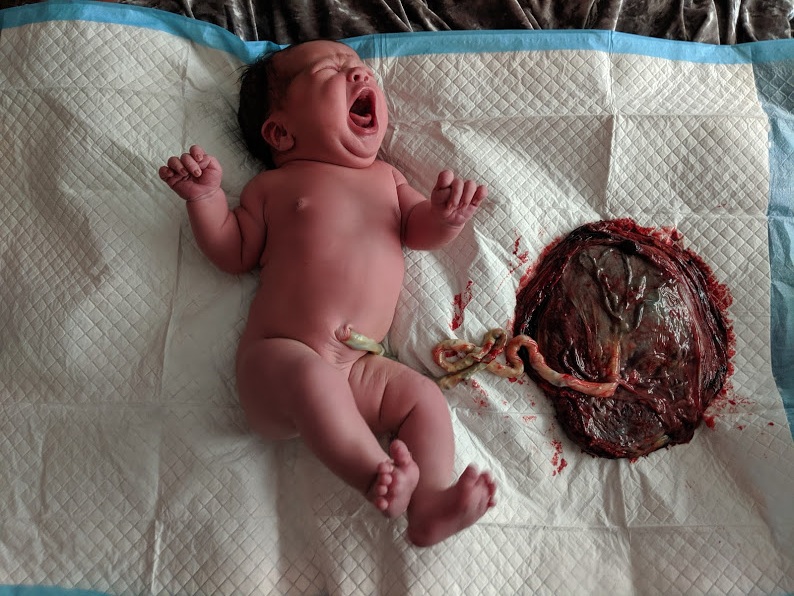 newborn-crying-placenta