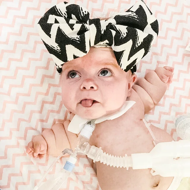 Paisley Life With Thanatophoric Dysplasia Macy Gilson