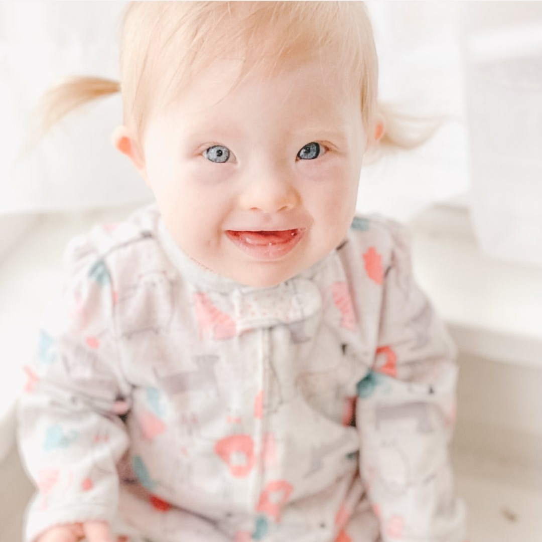 What Causes Down Syndrome? — Macy Gilson