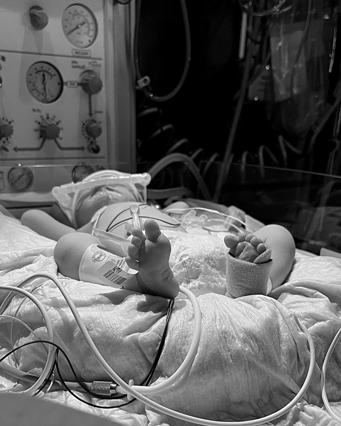 by nothing short of an absolute miracle, we welcomed our son into the world after months of desperately praying for the chance to meet him on this side of heaven 🕊️
REEVES CAPEN GILSON
the strongest boy we’ve ever met, named after his mama.