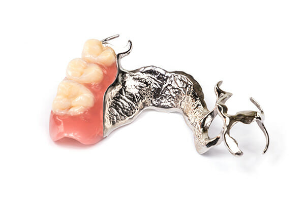 burbankdentallab-rdd-vitallium-alone-fig1.jpg