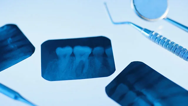 gty_dental_xray_ll_120410_wmain.jpg