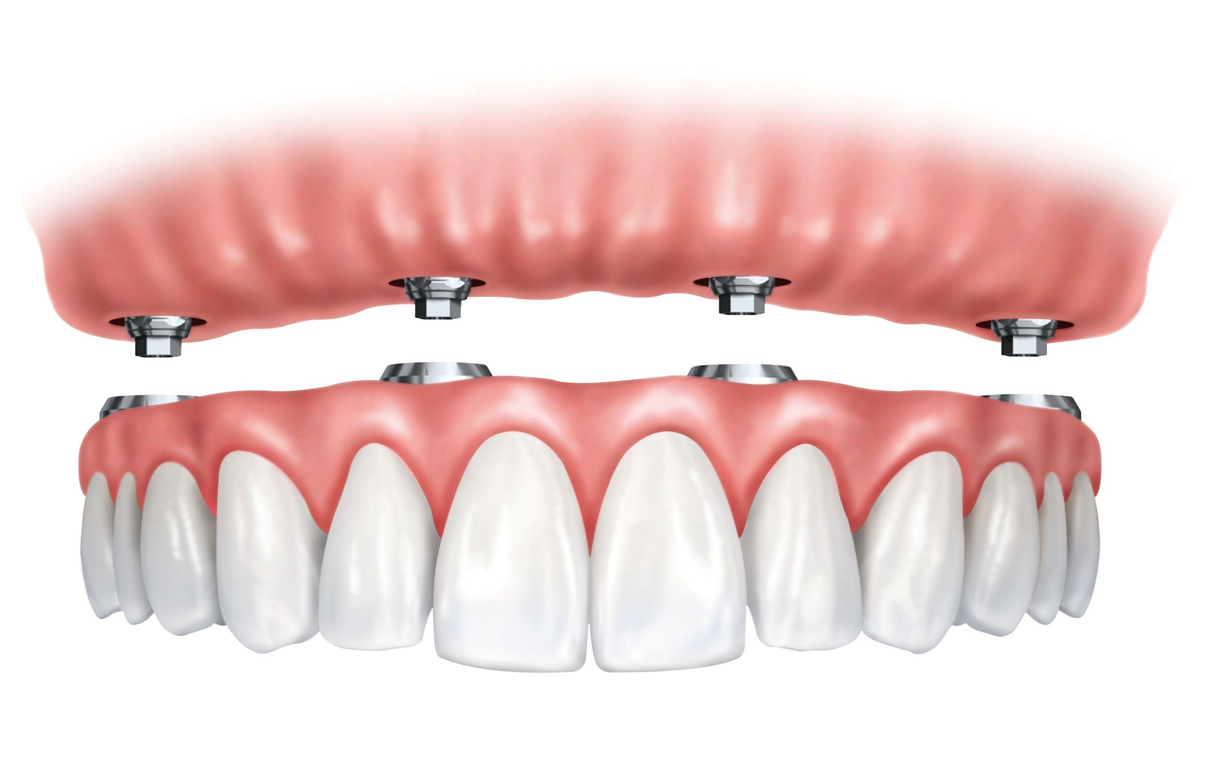Несъемное стоматологическое протезирование