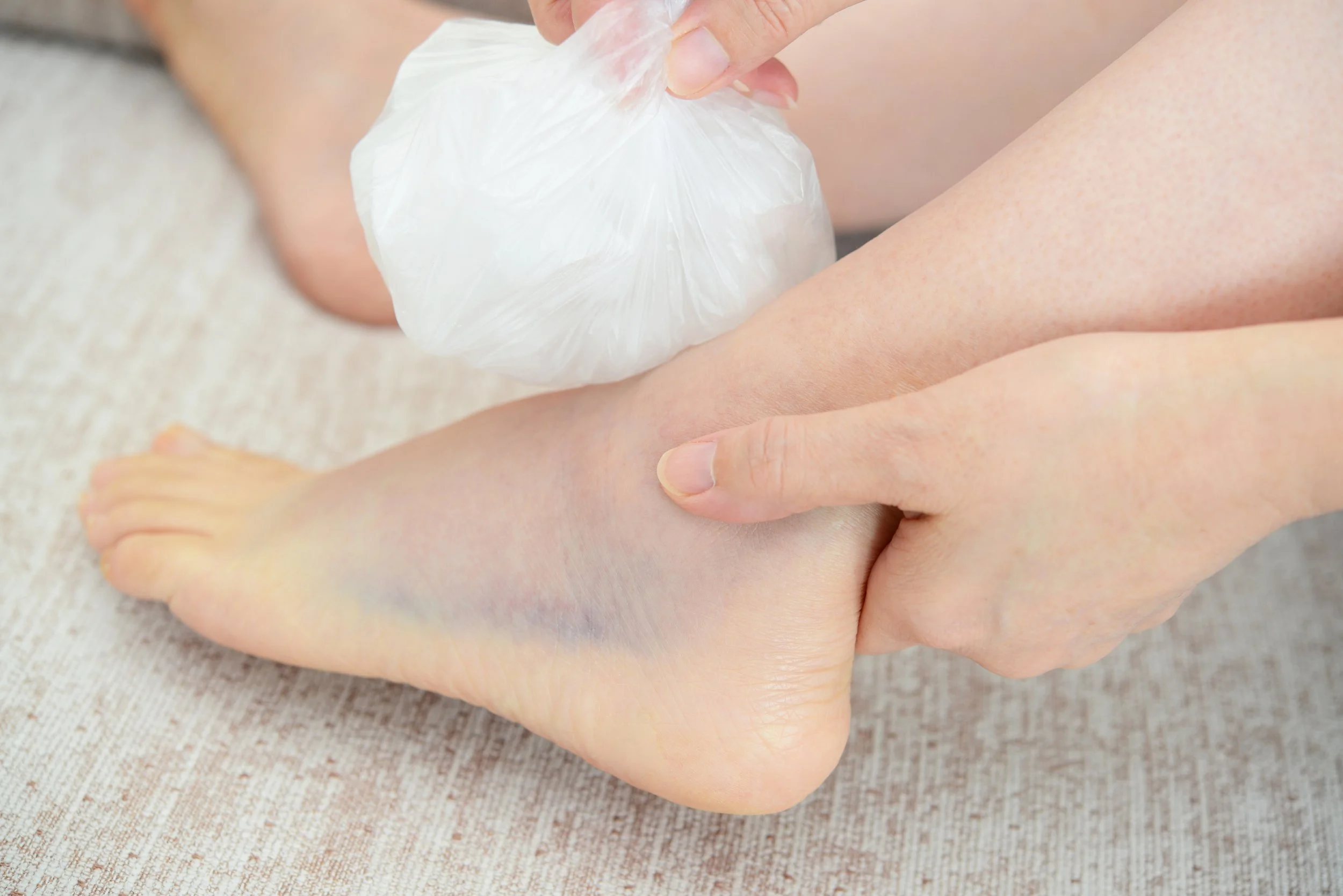 Don’t underestimate ankle sprains!