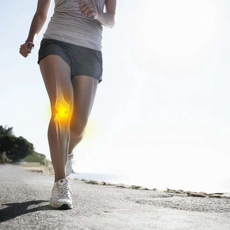 Running and Patellofemoral Pain Syndrome
