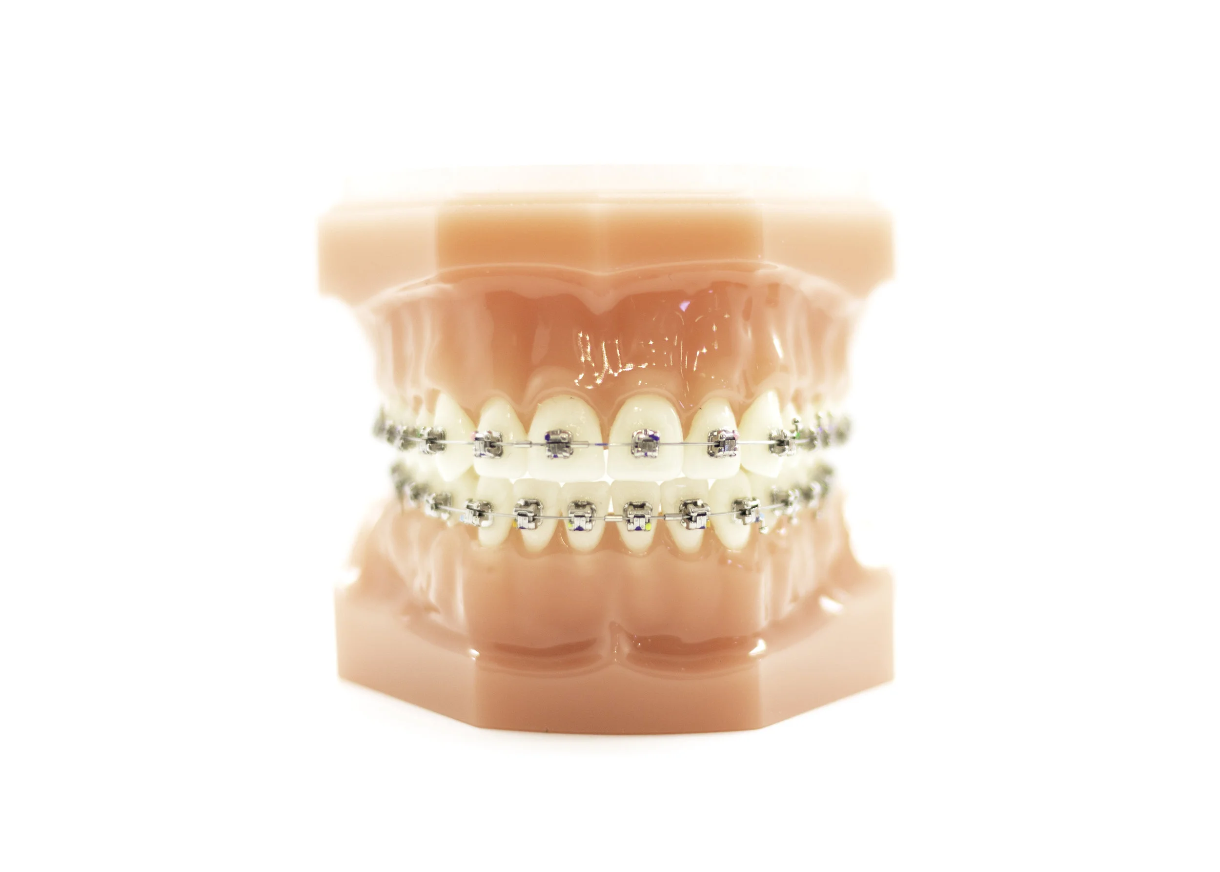 Teeth model with metal braces