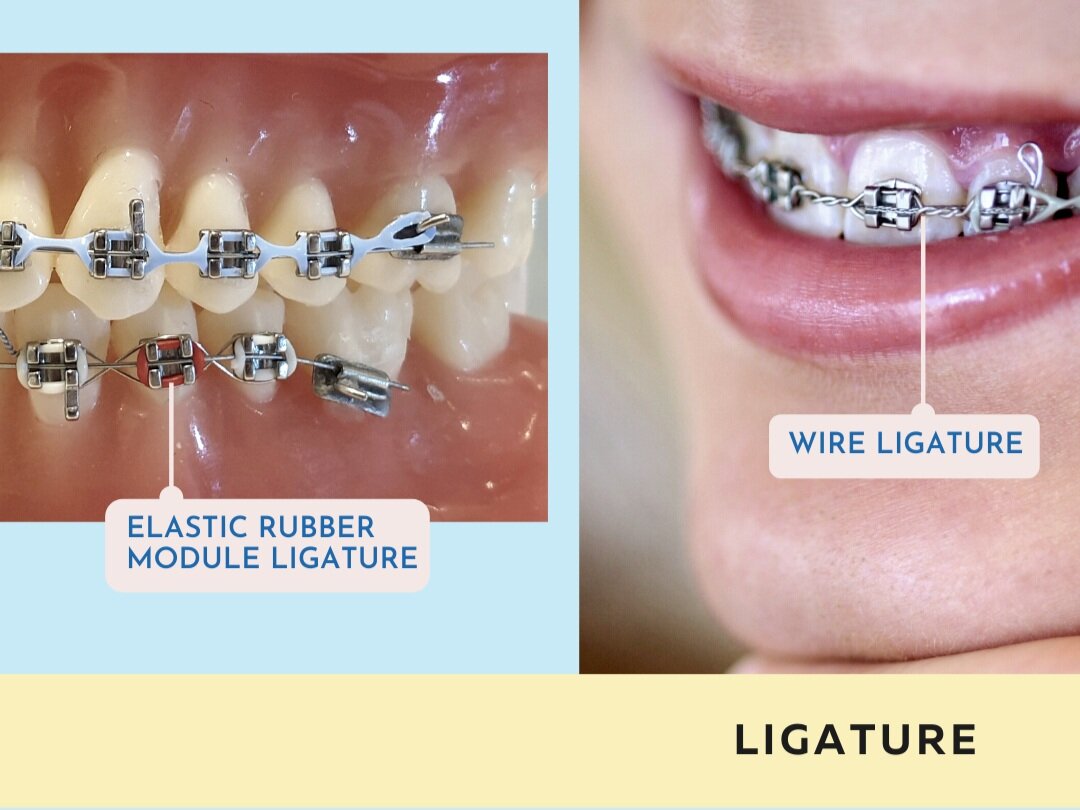 Align Braces Clinic, Singapore Orthodontist & Dentist