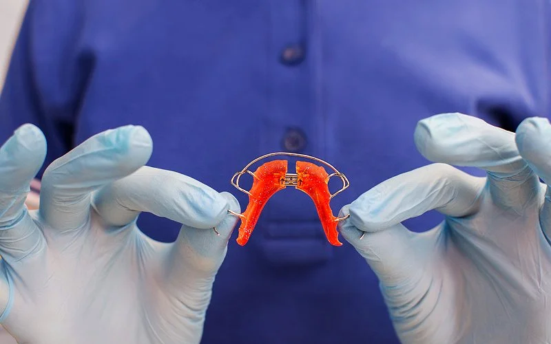 Orthodontist holding a dental expander for pediatric mouth breathing.