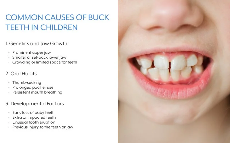 Infographic listing common causes of buck teeth in children.