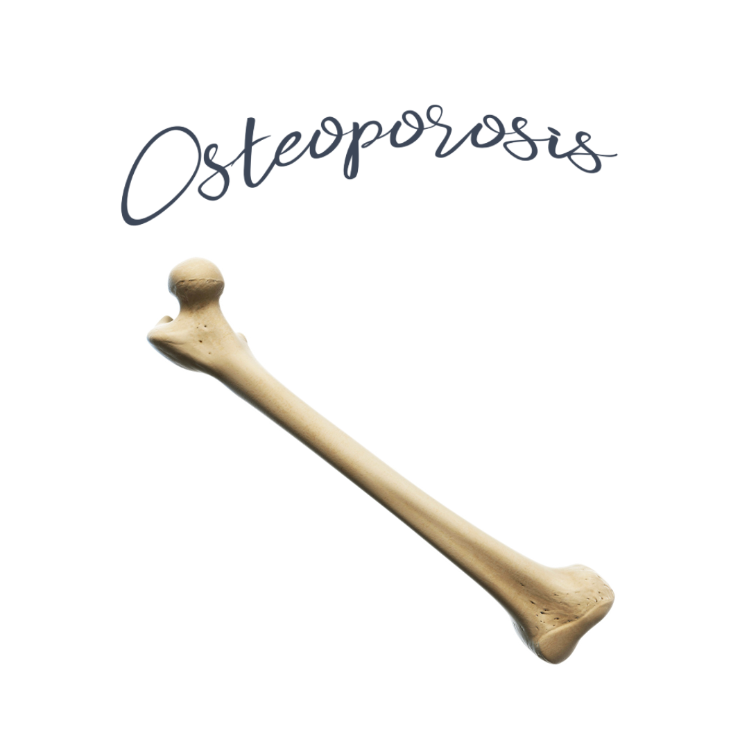 Osteoporosis and the menopause