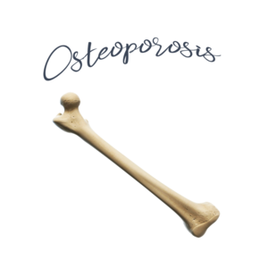Osteoporosis and the menopause