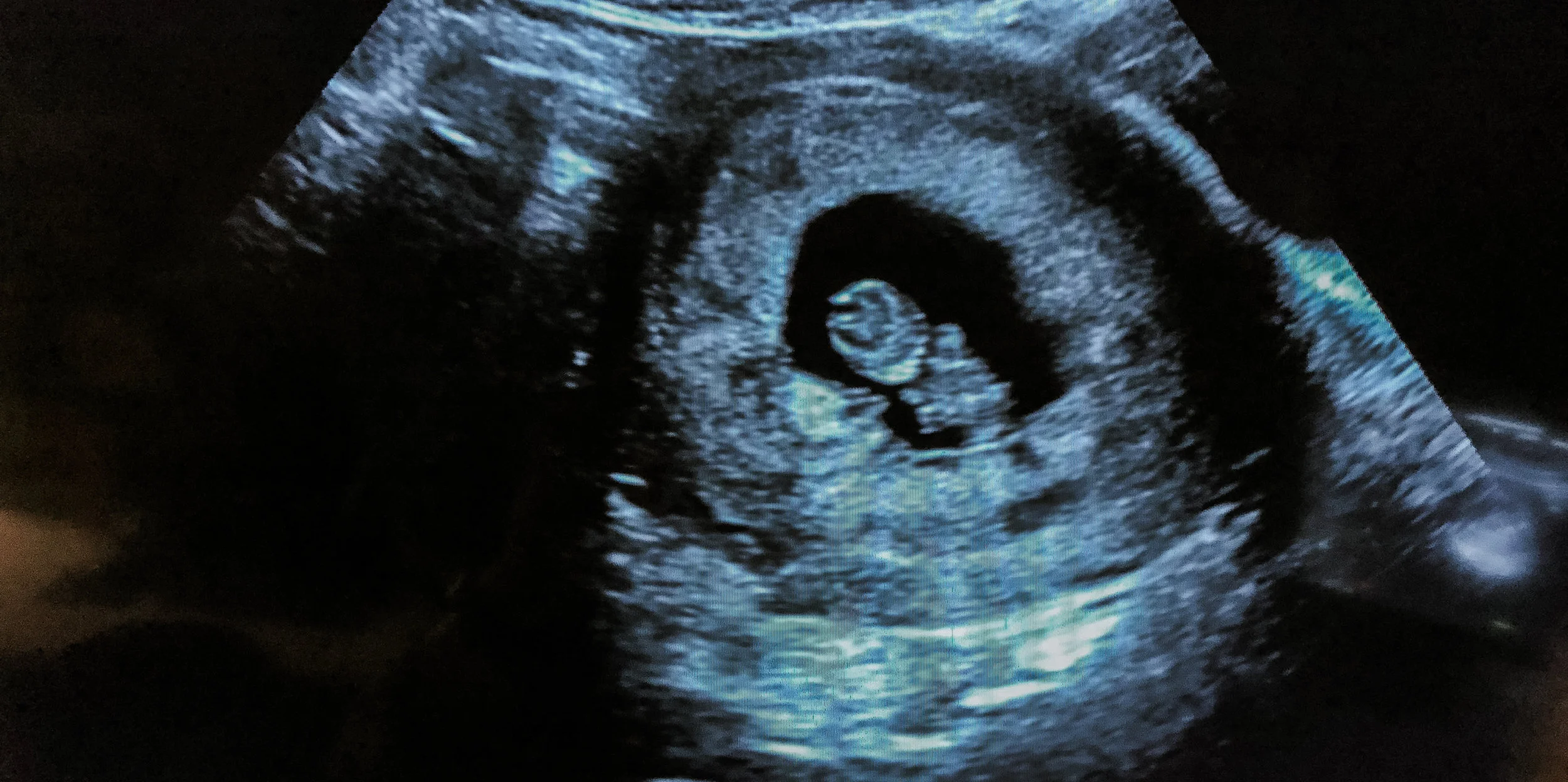 Ultrasound.jpg