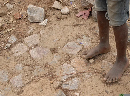 street feet.jpg