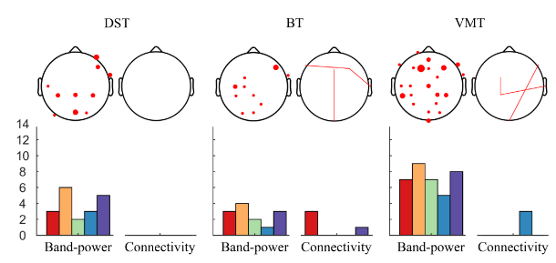 EEG-based Investigation of the Impact of Classroom Design on Cognitive Performance of Students