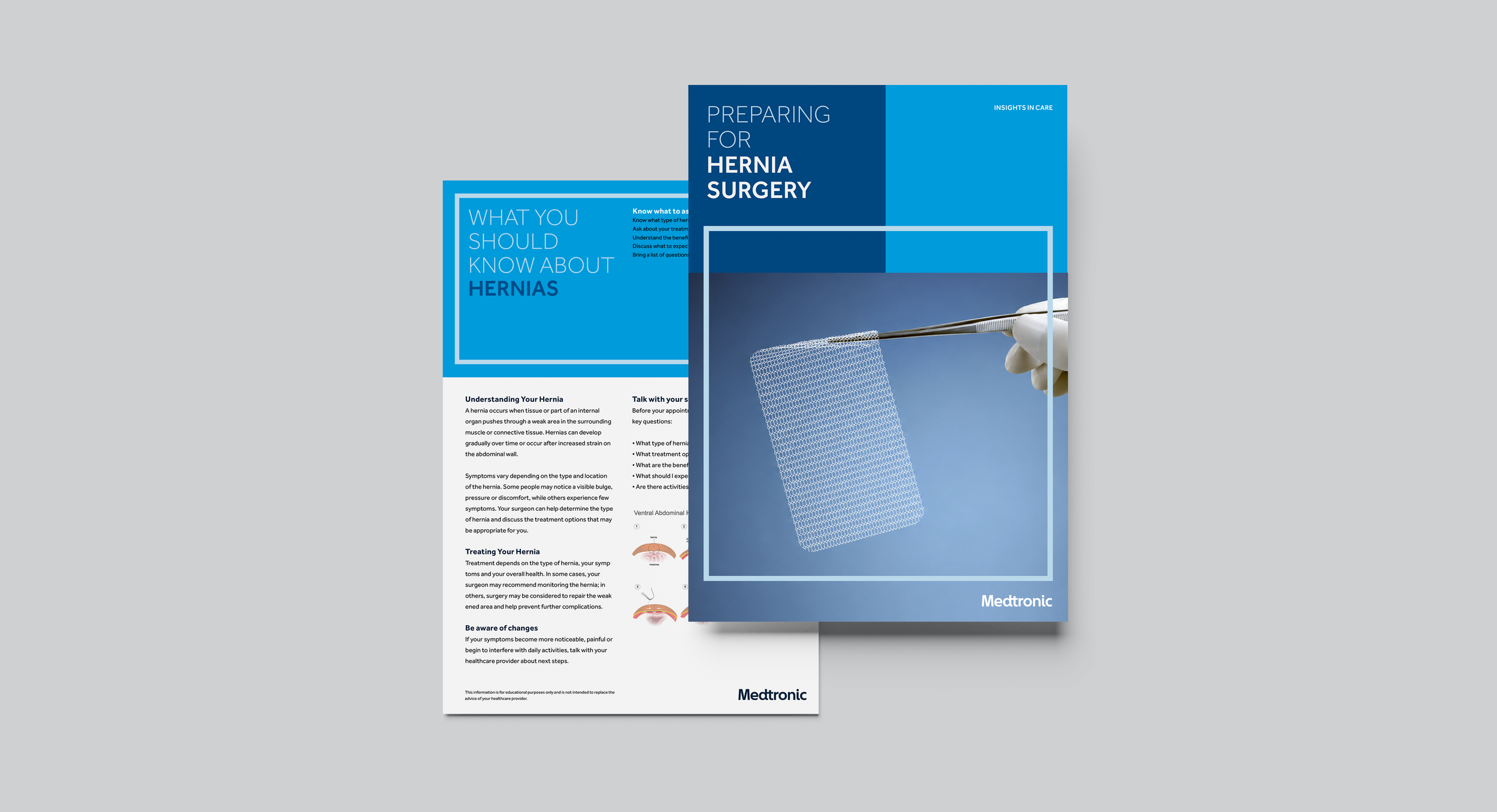 medtronic_hernia4.png