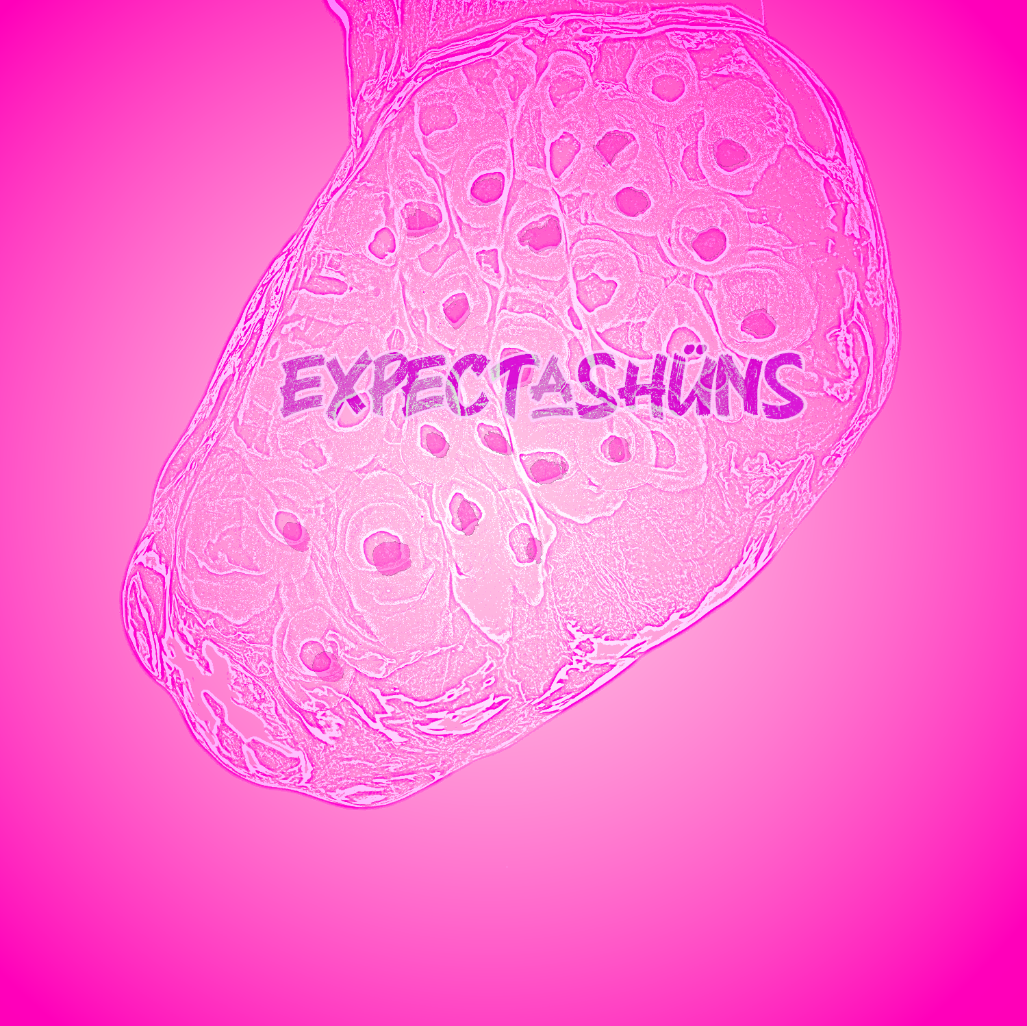 expectashuns_COVER.png