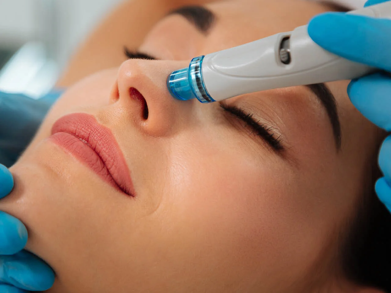 Hydrafacial Treatments Offer Benefits For All Skin Types - Rejuv Carlsbad - San Diego - Encinitas CA - Near Me