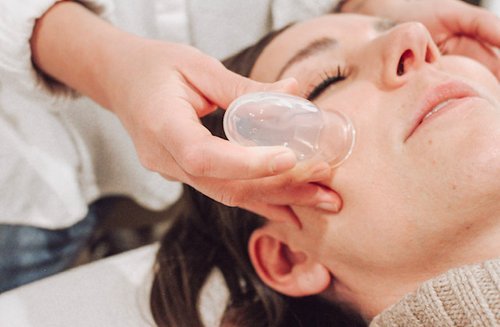 Cosmetic Acupuncture