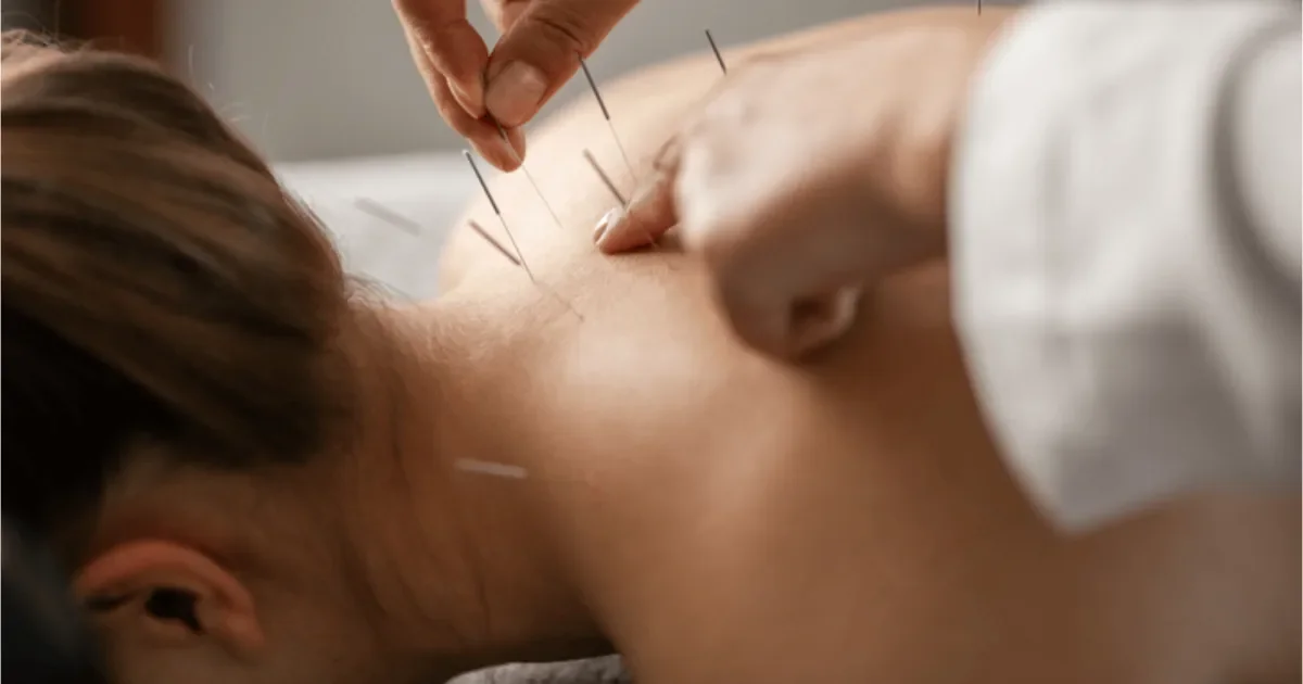 Does Acupuncture help with Flu and Seasonal Allergies? 